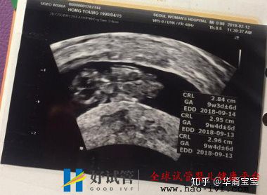 我刚做完试管,告诉你们今年试管婴儿价格多少钱(图1) 我刚做完试管,告诉你们今年试管婴儿价格多少钱(图1)