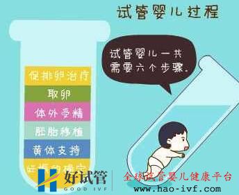 试管婴儿的过程步骤(图2) 试管婴儿的过程步骤(图2)