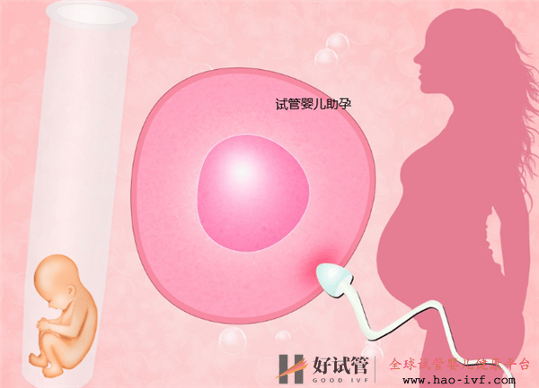 试管婴儿基础知识和注意事项(图1) 试管婴儿基础知识和注意事项(图1)