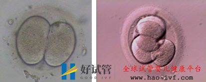 您无精少精的情况可以做试管婴儿吗(图1) 您无精少精的情况可以做试管婴儿吗(图1)