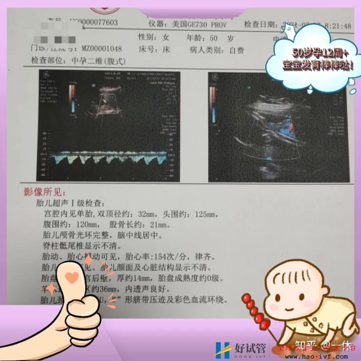 公立医院做三代试管的条件,看看你真的能做吗(图1) 公立医院做三代试管的条件,看看你真的能做吗(图1)