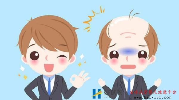 多大年龄都可以植发吗?想植发需要什么条件才可以?(图2) 多大年龄都可以植发吗?想植发需要什么条件才可以?(图2)