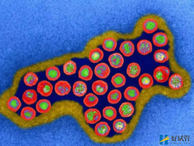 子宫内膜癌早期病症表现科普,这6个危险信号别忽视!(图1) 子宫内膜癌是恶性肿瘤