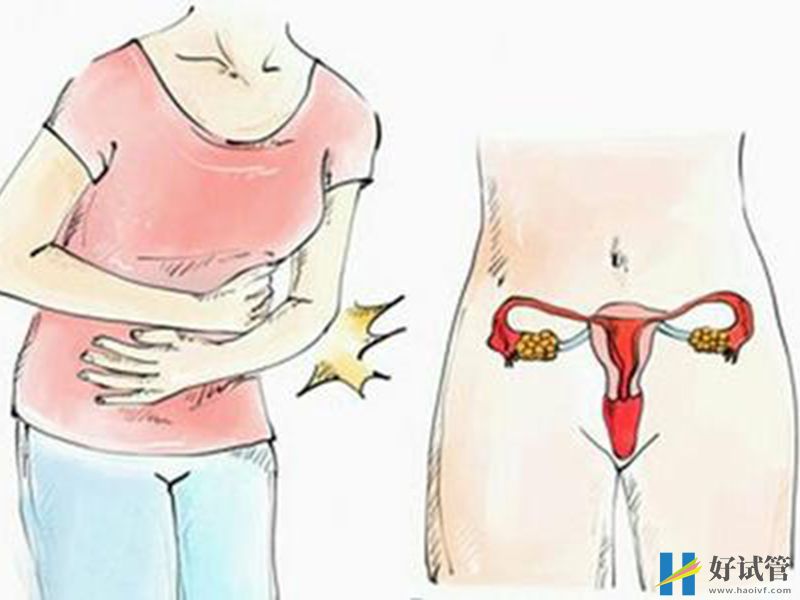 不知道纵隔子宫?它会将正常的子宫分割成两个空间(图1) 子宫纵膈的症状