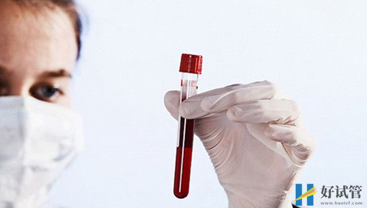 卵泡不破时要对症治疗,这几种检查手段你一定要知道(图1) 卵泡不排时要先检查原因