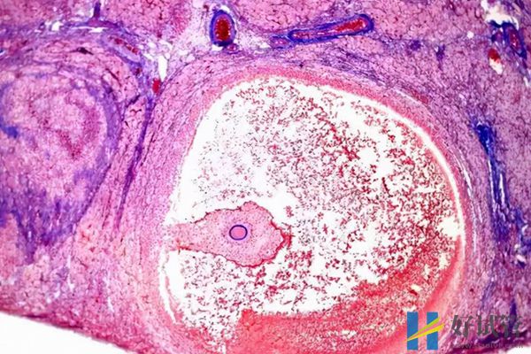一文讲清优质卵泡大小是多少mm,与普通卵泡的区别要了解(图1) 优势卵泡直径大小在10mm以上