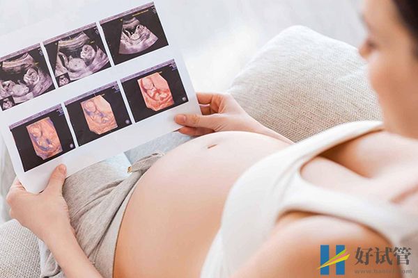 20号染色体三体综合症详解:这些情况一定要了解(图2) 染色体三体会导致胎儿畸形