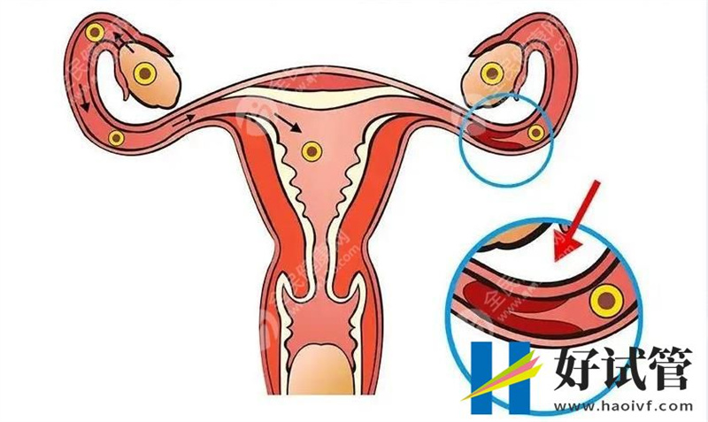 黔东南第三代试管婴儿多少钱,贵不贵?(图1) 黔东南第三代试管婴儿多少钱,贵不贵?(图1)