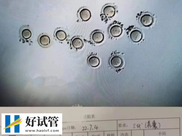 广东省妇幼三代试管婴儿流程讲解,术前检查是第一步(图1) 做三代试管需要养囊