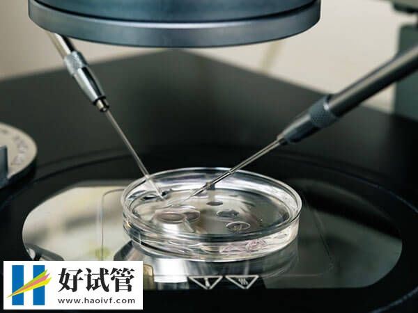 探秘重庆市妇幼保健院人工受孕,附项目收费情况及着床率(图1) 重庆市妇幼保健院试管贵不贵