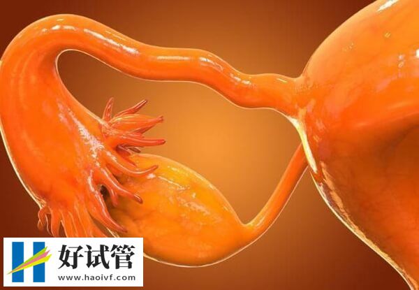 供精做试管婴儿的利弊(图2) 供精做试管可能会导致卵巢早衰