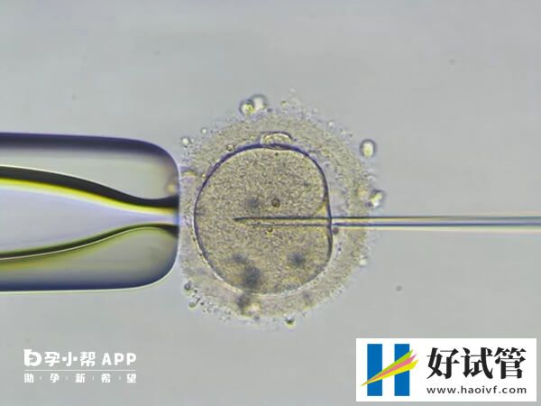 icsi是二代试管婴儿的缩写