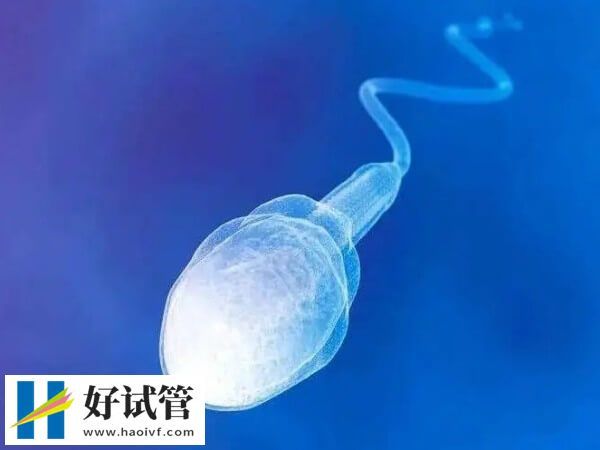 做供精试管婴儿的条件有哪些(图1) 做供精试管婴儿要满足的条件