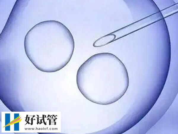 大连做试管婴儿条件是什么(图1) 大连未婚女性不能做试管婴儿