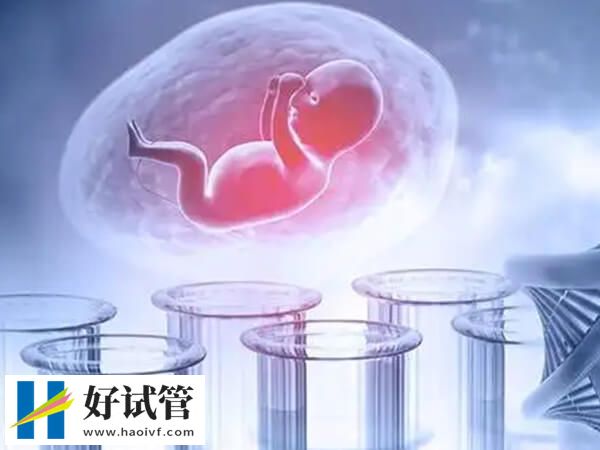 扬州哪个试管专家好(图1) 扬州做试管婴儿选董乃俊医生好