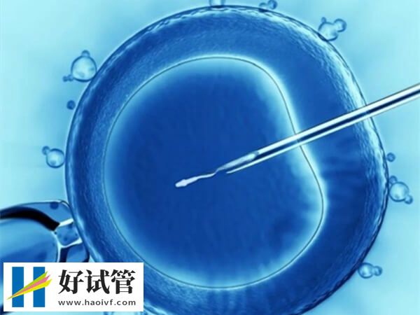 徐州试管成功率高不高(图1) 徐州试管婴儿成功率约50%-60%