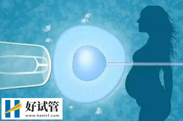 徐州试管成功率高不高(图2) 年龄是影响试管成功率的因素之一