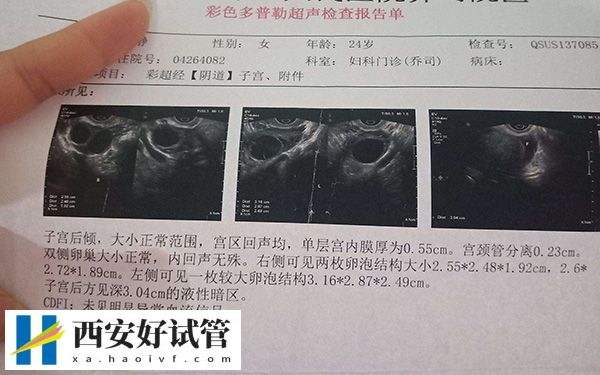 三个卵泡都破了怀孕的几率多大(图3)