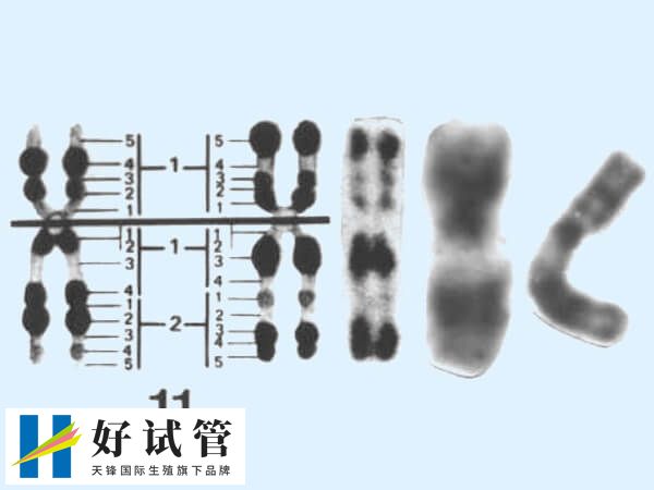 试管多次不着床需要查什么(图1) 染色体检查可判断胚胎是否异常