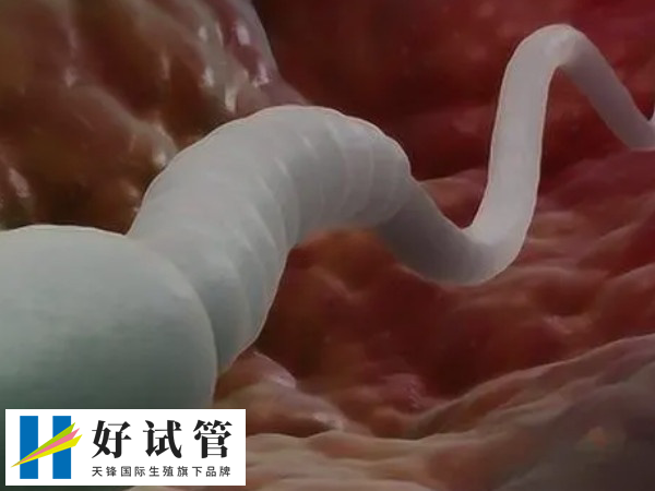 生男生女取决于精子