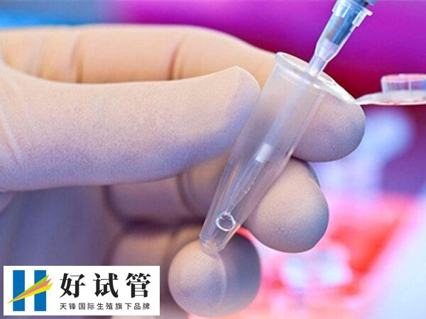 试管促排卵有哪些注意事项(图1) 促排卵期间要严格遵医嘱用药