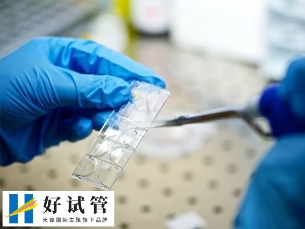 取卵时能不能看出卵子质量(图1) 试管婴儿取卵过程并不复杂