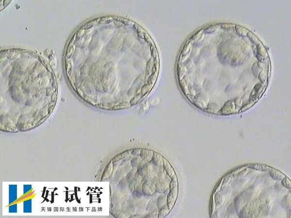 移植囊胚和三天胚胎是否一样(图1) 囊胚移植的成功率高于三天胚胎