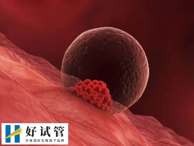 影响取卵数量的因素有哪些(图1) 卵泡发育成熟之后就可以安排取卵