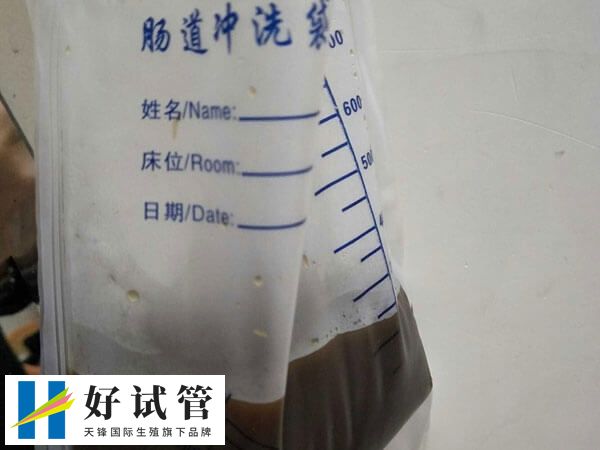 试管降调期间能不能灌肠治疗(图1) 灌肠一般指灌肠术