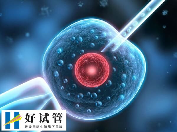 取卵手术的过程是什么(图1) 取卵手术是一个相对简单的过程