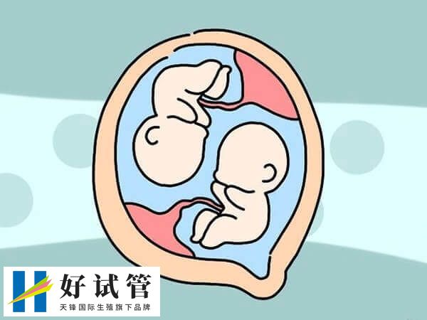 胚胎是男性或女性也是一个随机事件