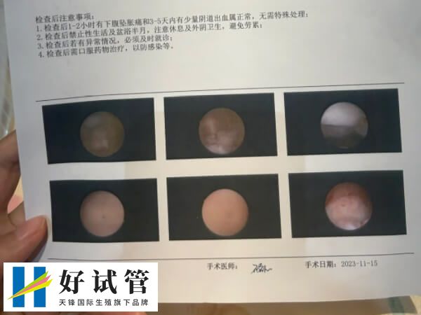 试管婴儿是现代医学技术的奇迹