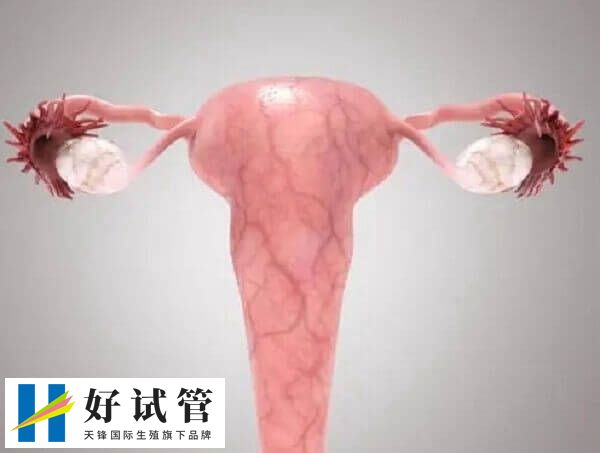 子宫腺肌症打达菲林有没有效果(图4) 子宫腺肌症用达菲林治疗可能会导致闭经