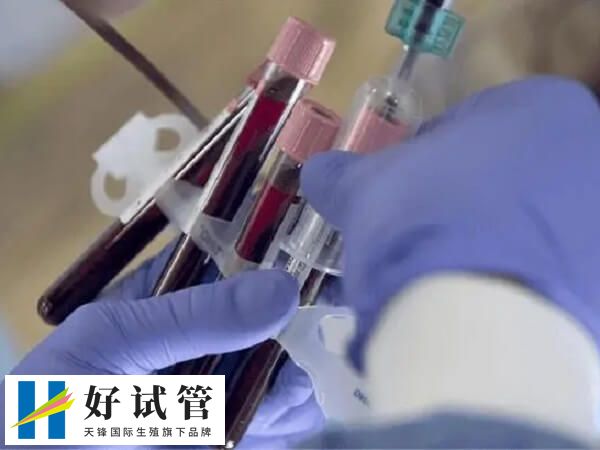 检查性激素六项过程是怎样的(图2) 抽血检查血清中的六种激素