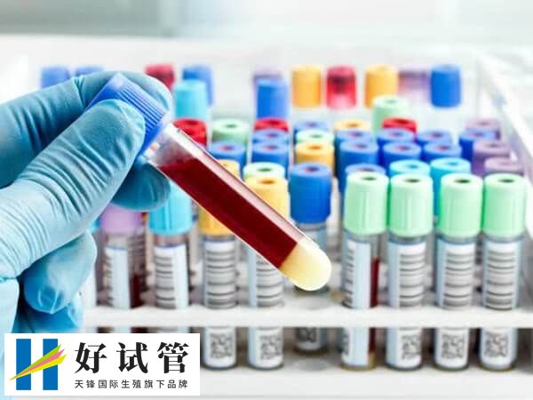 检查性激素六项过程是怎样的(图3) 医院挂妇科号检查