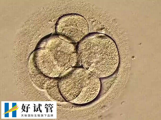 4bb囊胚质量等级高不高(图2) 4BA囊胚属于优质囊胚