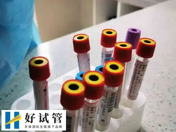 试管促排促黄体生成素是不是越低越好(图2) 促排前的降调节目的是抑制内源性激素波动